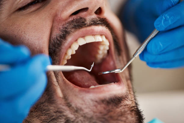 Best Root Canal Treatment  in Mcgregor, TX